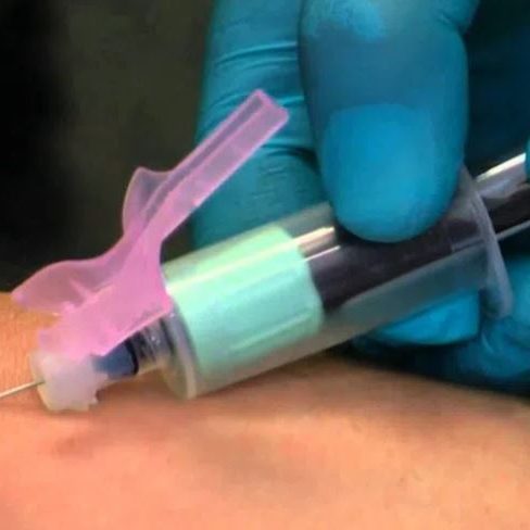 Venipuncture